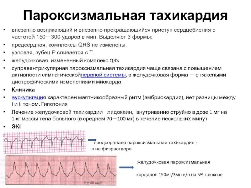 Сердцебиение повышено причины. Пароксизмальная тахикардия экг. учащенное сердцебиение тахикардия. синусовая тахикардия причины. тахикардия симптомы и причины.