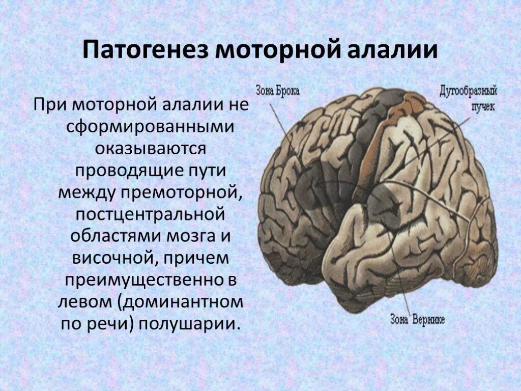 Нарушение полушарий мозга. Алалия Вернике Брока. Мозговые механизмы сенсорной алалии. Сенсорная алалия зона Вернике. Мозговой механизм нарушения при моторной алалии.