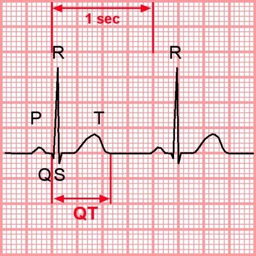 Синдром удлиненного qt на ЭКГ. Удлиненный интервал qt на ЭКГ что это такое. Удлинение интервала qt на ЭКГ. Синдром удлиненного интервала qt.