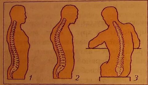 Правильный позвоночник