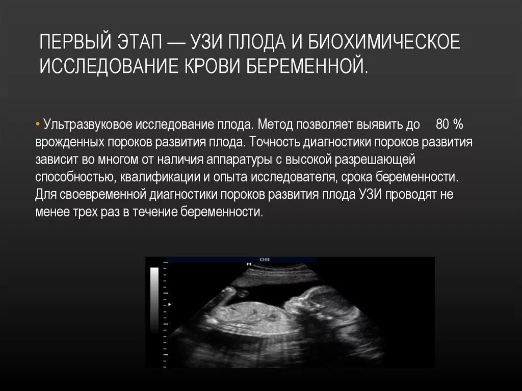 Диагностика плода. Пороки развития плода на узи. эхография плода аномалии развития. ультразвуковое исследование плода распространенный метод. узи на пороки развития плода аномалии.