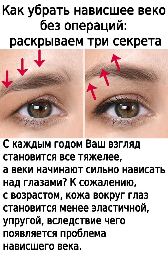 Как убрать нависшее веко. Как удаляют нависшее веко. Почему у европейского лица нависшее веко. Нависшее верхнее веко что делать