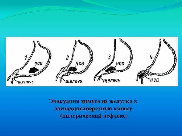 Эвакуация содержимого. Механизм эвакуации пищи из желудка в 12 перстную кишку. механизм эвакуации химуса в 12-перстную кишку. механизм эвакуации химуса из желудка. переход содержимого желудка в двенадцатиперстную кишку.
