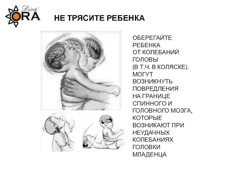 Тряска детей. Синдром встряхнутого ребенка. Синдром тряски младенца. Синдром тряски ребенка симптомы.