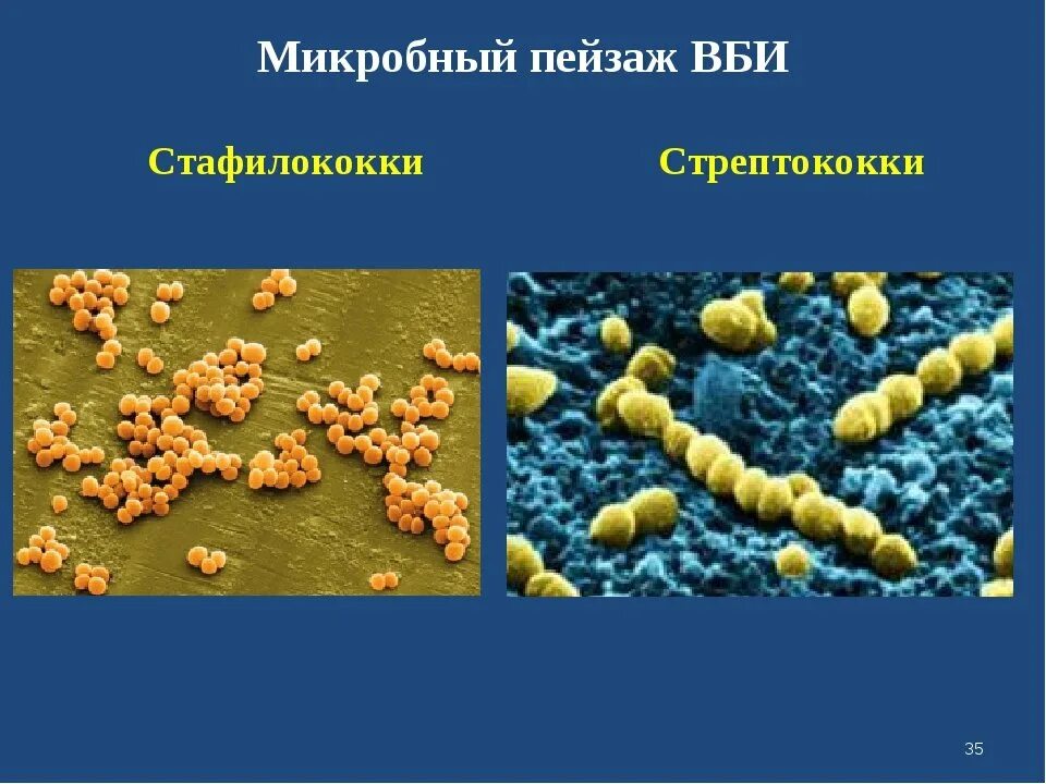 Стафилококк строение. Бактерия стафилококк строение. Staphylococcus aureus строение. Золотистый стафилококк строение клетки.