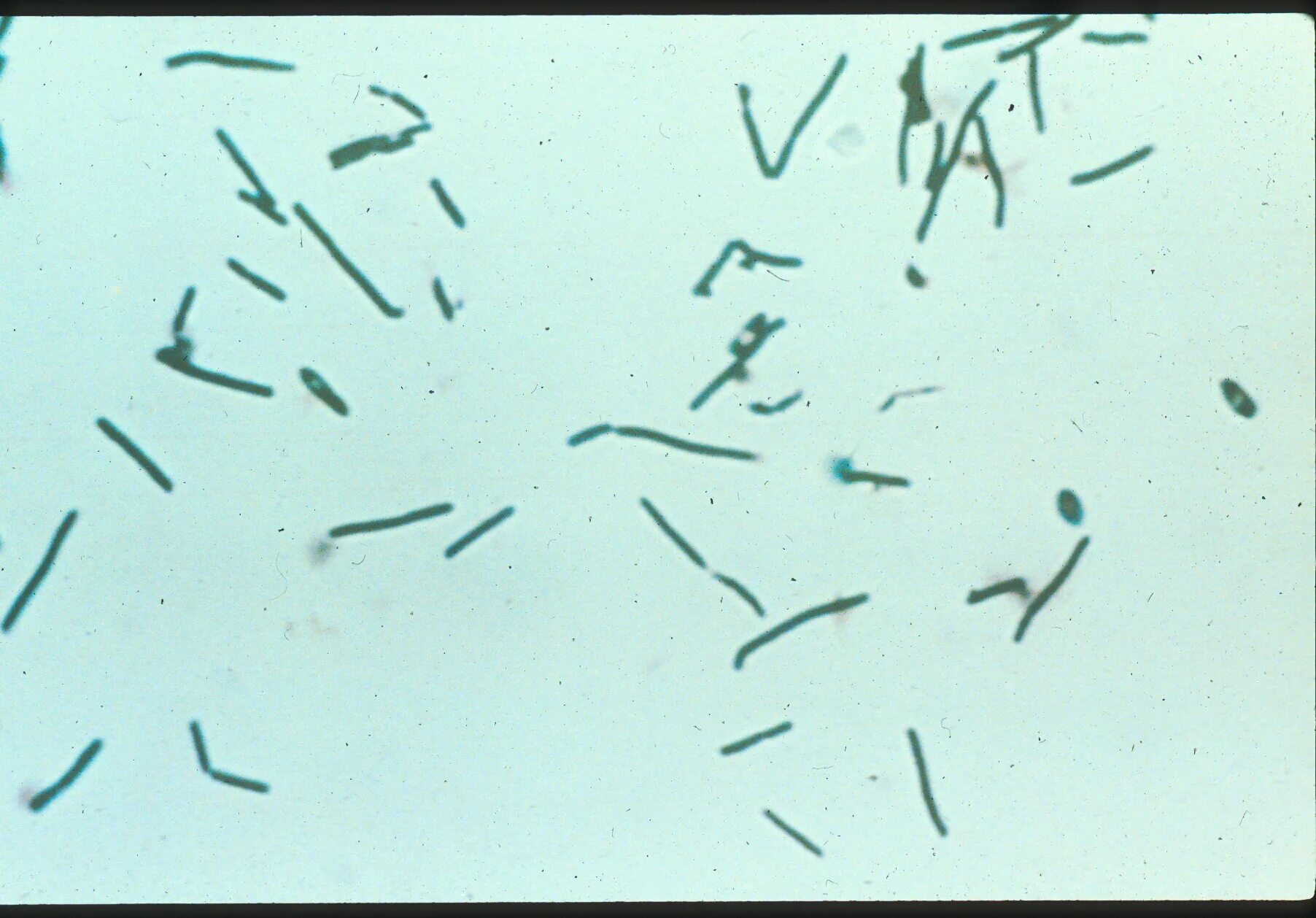 Clostridium botulinum микроскоп. Clostridium chauvoei возбудитель. Клостридия диффициле микроскопия. Клостридии ботулизма.