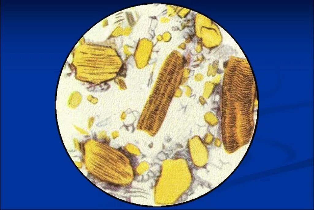Растительная неперевариваемая клетчатка в кале у взрослого. Микроскопия кала копрограмма. Атлас копрограмма микроскопия. Мышечные волокна в Кале микроскопия. Копрограмма мышечные волокна.