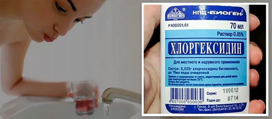 Хлоргексидин можно беременным полоскать. Хлоргексидин для полоскания горла. хлоргексидин для полоскания горла при ангине. хлоргексидин раствор для полоскания горла. полоскалка для горла в дом условиях.