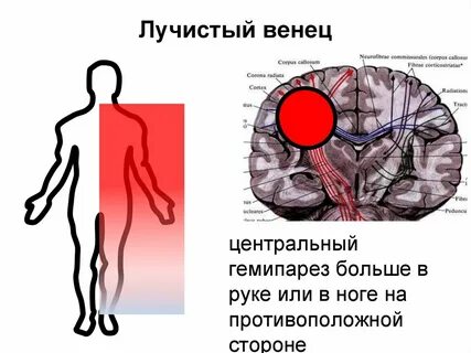 Лучистый венец