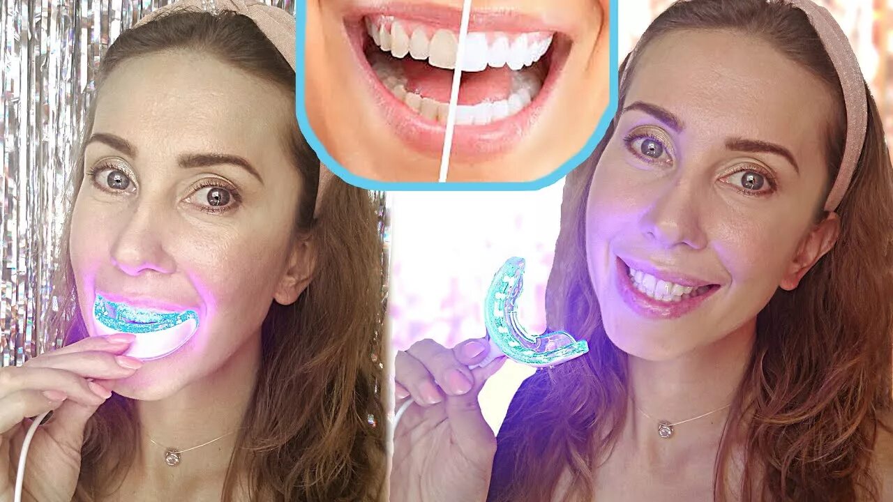 InOssetiaSmile, стоматологическая клиника, пер. Станиславского, 4, Владикавказ -