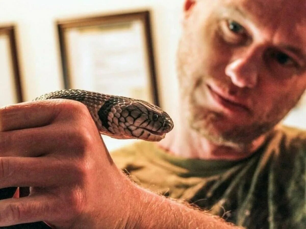 Snake bites
