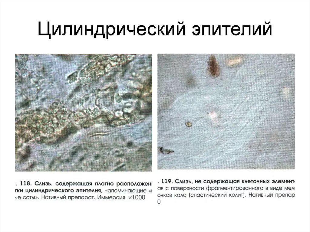 Цилиндрический эпителий микроскопия кала. Клетки цилиндрического эпителия в Кале. Круглый эпителий микроскопия. Цилиндрический эпителий в Кале микроскопия.