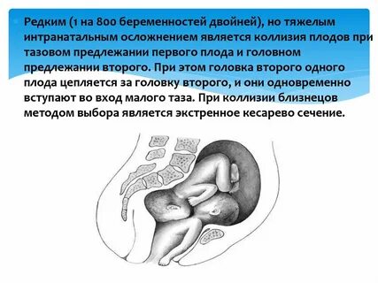 Многоводье на 39 неделе