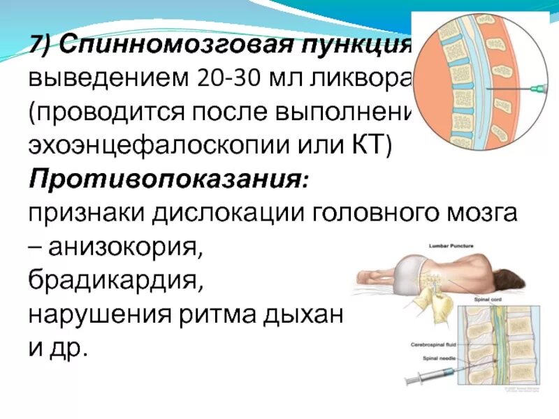 Пункция мозга последствия