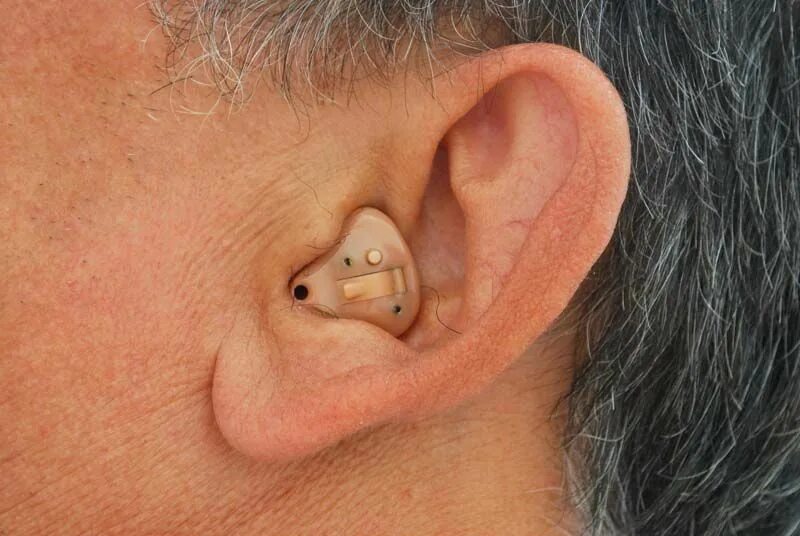 Ear hearing