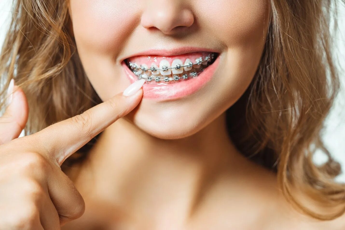 Pointed teeth