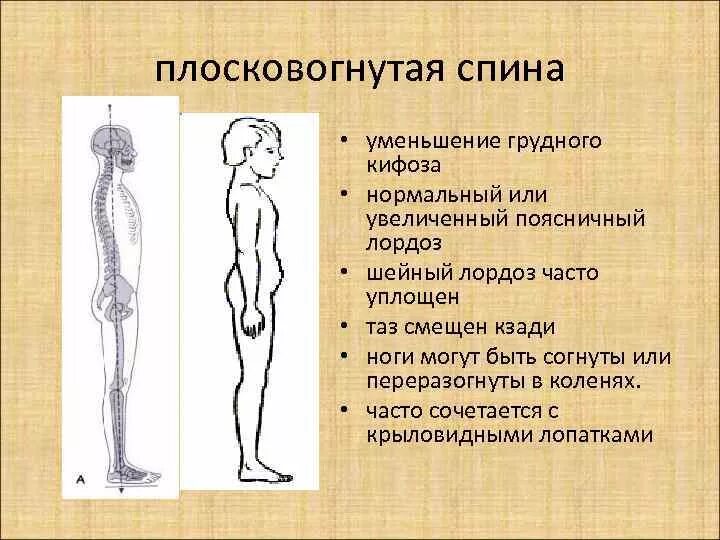 Каковы причины осанки. Каковы причины осанки