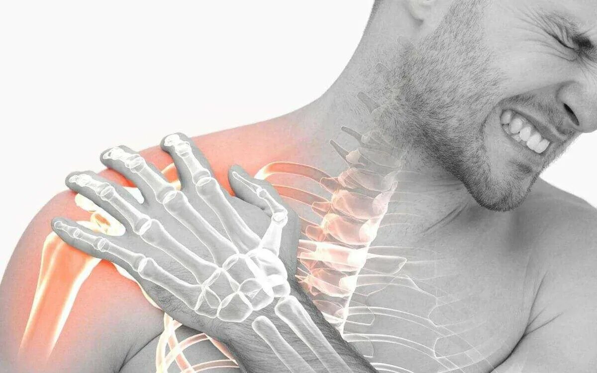 Боль при трещине. Туннельный синдром плечевого сустава. Плексит плечевой плексит.