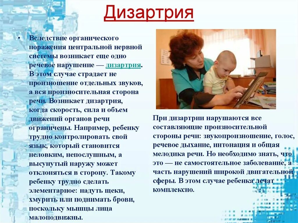 Дизартрия у детей. Дизартрия. дизартрия у детей что это. дизартрия речи у детей. дизартрия у детей что это такое симптомы.