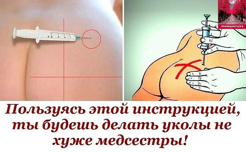 Не получается делать инъекции. Как правильно сделать внутримышечный укол в ягодицу. как правильно ставить укол. как делать укол. как правильно делать укол внутримышечно.
