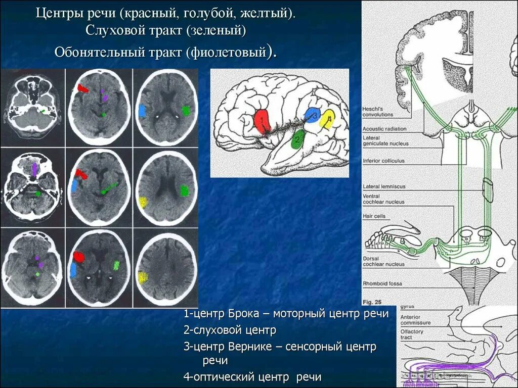 Зеленый тракт. Слуховой центр центр вернике. слуховой центр речи. слуховой тракт. корковый центр слуха зона гешле.