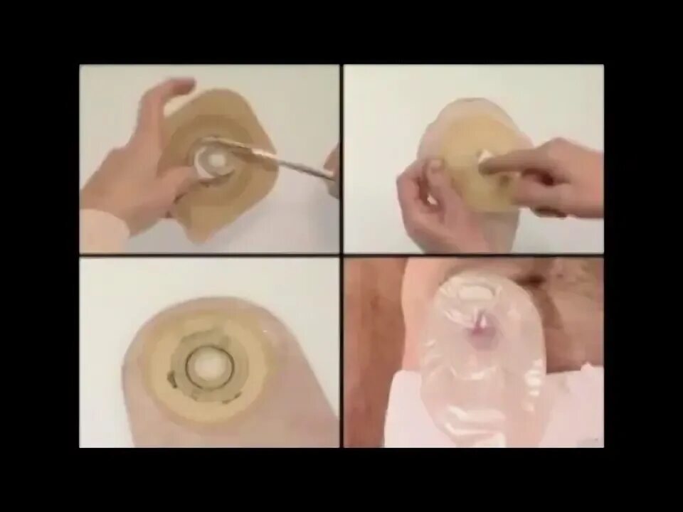 Как клеить стомы