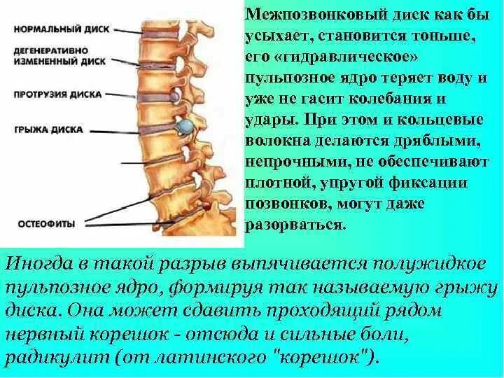 Протрузия шейного отдела позвоночника симптомы. Протрузия позвоночника. Межпозвоночный диск. Остеохондроз протрузии межпозвонковых дисков. Протрузия дисков позвоночника что это такое.