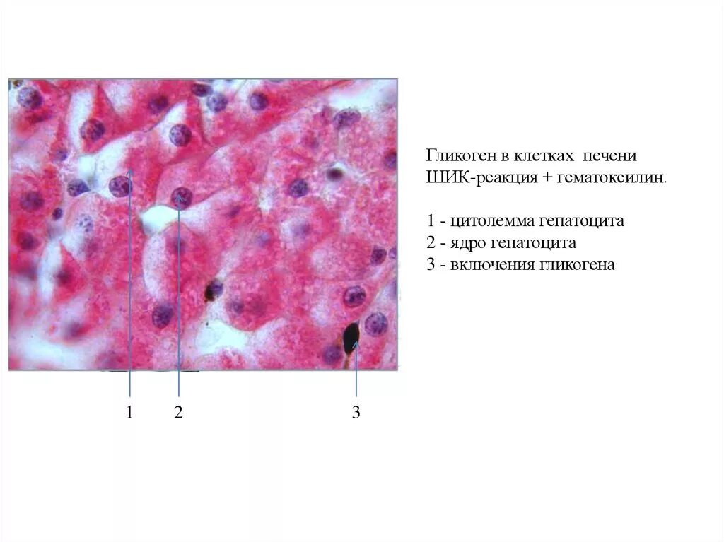 Включения гликогена в клетках печени Шик реакция. Включения гликогена в печени аксолотля. Препарат общая морфология клетки. Препарат общая морфология клетки печень аксолотля.