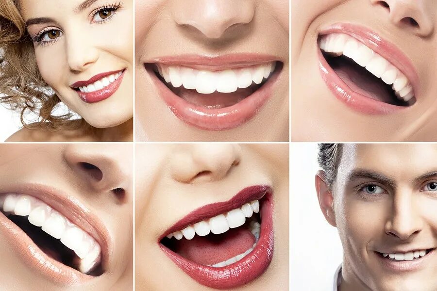 Example smile. Красивая форма зубов. Что значит. Красивая форма зубов. Similes in english.