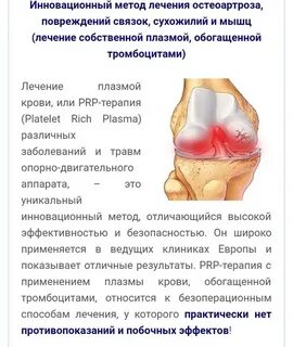 Артроз коленного сустава лечение лазером