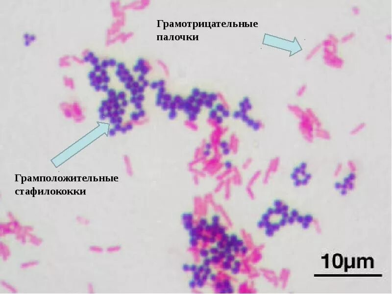Смесь бактерий в окраске по граму. Смесь бактерий. Смесь бактерий. Лактобактерии это молочнокислые бактерии. Смесь бактерий.