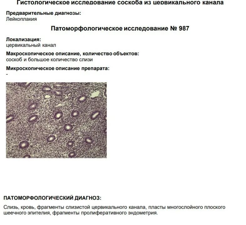 Заключение биопсии шейки матки расшифровка. Макроскопическое описание биопсии шейки матки. Биопсия шейки матки гистология. Гистология биопсия желудка расшифровка. Крови после биопсии шейки