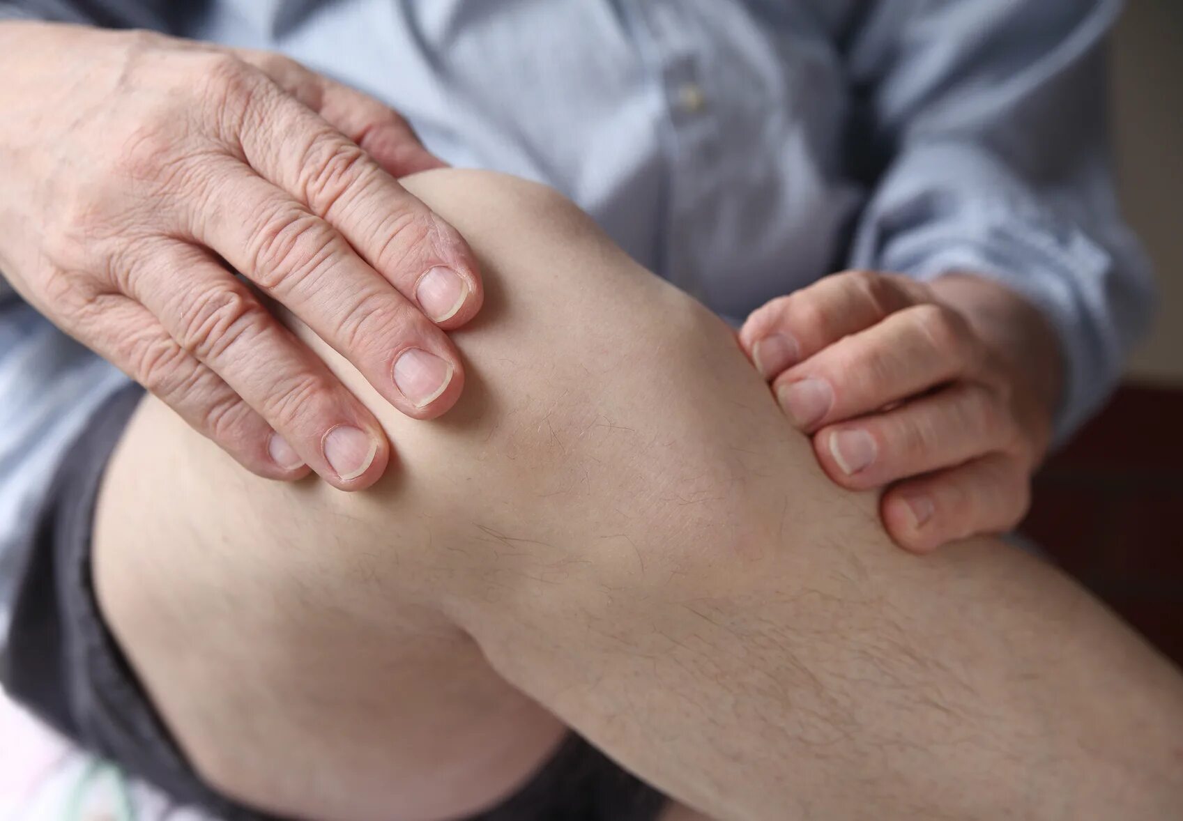 Артропатия лечение. Гигрома коленного сустава.