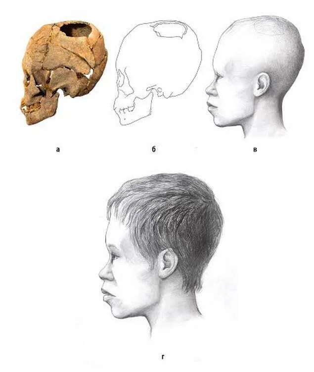 Варианты формы черепа. Трепанация черепа на затылке. Форма черепа человека сбоку. Трепанация черепа первобытность. Формк черепа.