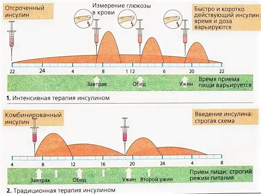 Техника набора инсулина. Схема введения инсулина при сахарном диабете 1. Инсулинотерапия при сахарном диабете 1 типа схема. Схемы введения инсулина короткого действия. Схема действия различных видов инсулина.