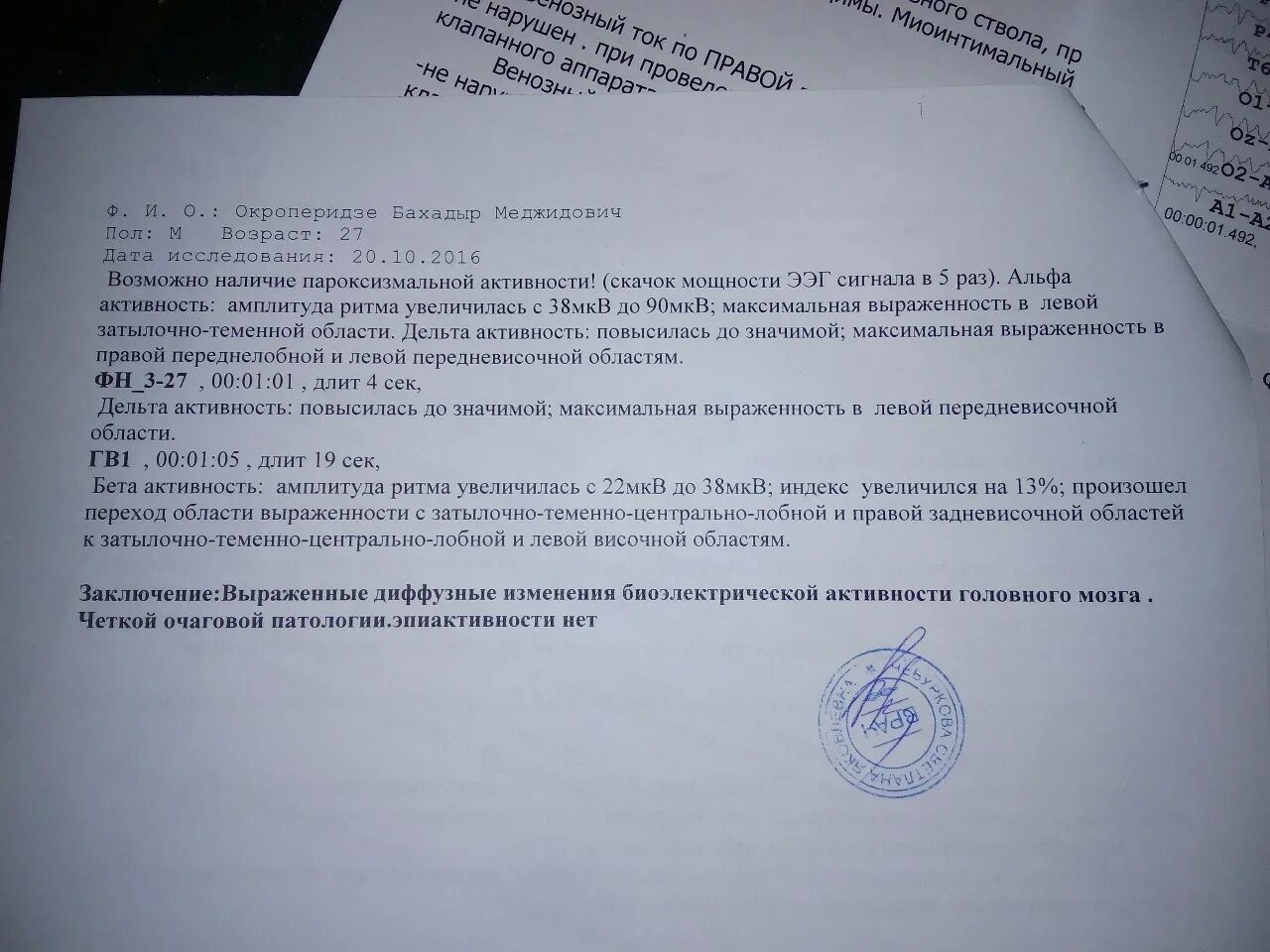 Сотрясение код по мкб 10. ЗЧМТ мкб. Диффузные изменения биоэлектрической активности головного мозга. ЗЧМТ код мкб 10. ЗЧМТ код по мкб 10 сотрясение головного мозга.