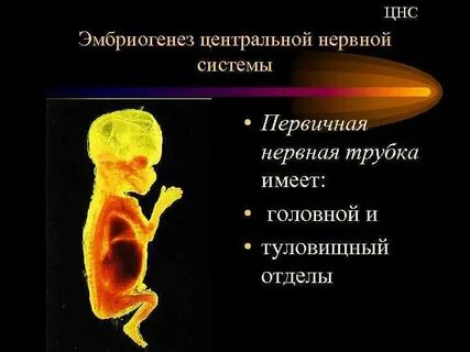 Органы из нервной трубки