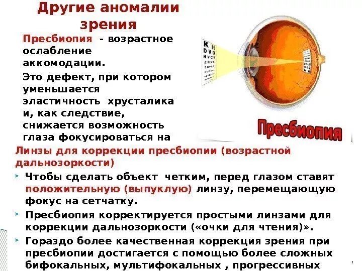 Пресбиопия что это простыми