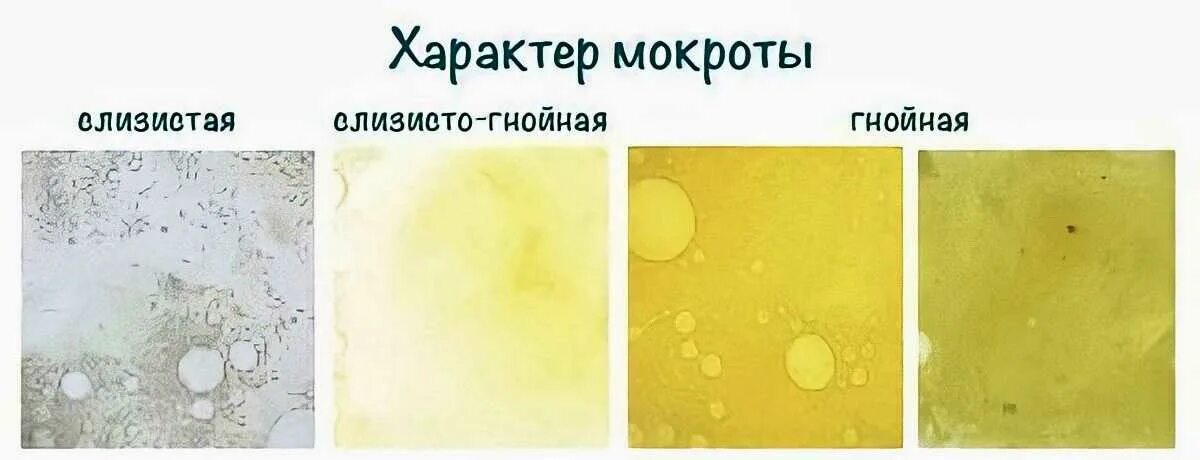 Мокрота без симптомов. Цвет слизисто-гнойной мокроты. нормальный цвет мокроты. мокрота желто зеленого цвета.