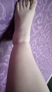 39 неделя отекают ноги