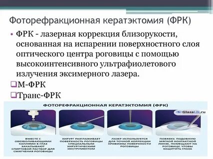 Методы лазерной коррекции зрения какой лучше
