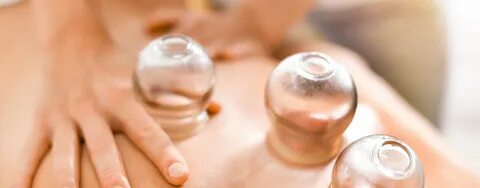 Cupping form