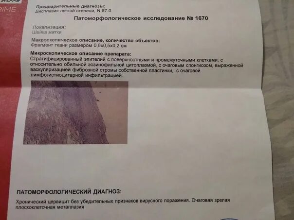 Струп после биопсии шейки матки как выглядит Биопсию больно брать