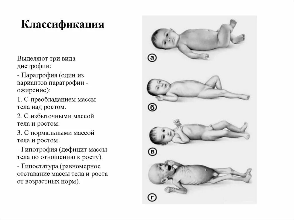 Дефицит веса у ребенка