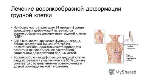 У новорожденного ребенка грудная клетка