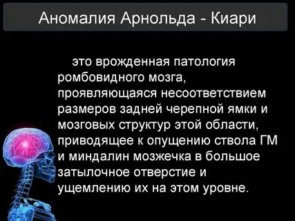 Что такое аномалия арнольда киари