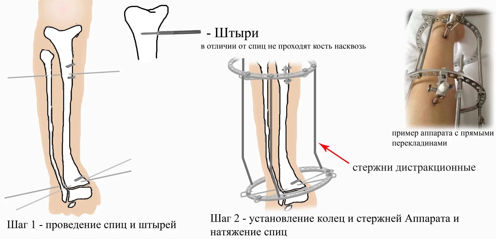 Форум удлинение