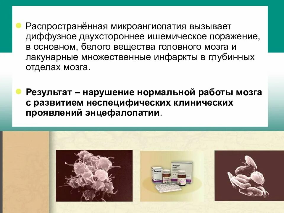 Микроангиопатия головного мозга что это. Клинические проявления микроангиопатии. микроангиопатия головного мозга что это такое. очаги микроангиопатии головного мозга что это такое. церебральной микроангиопатии.