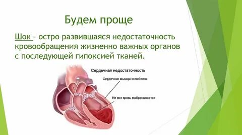 Острая недостаточность кровообращения