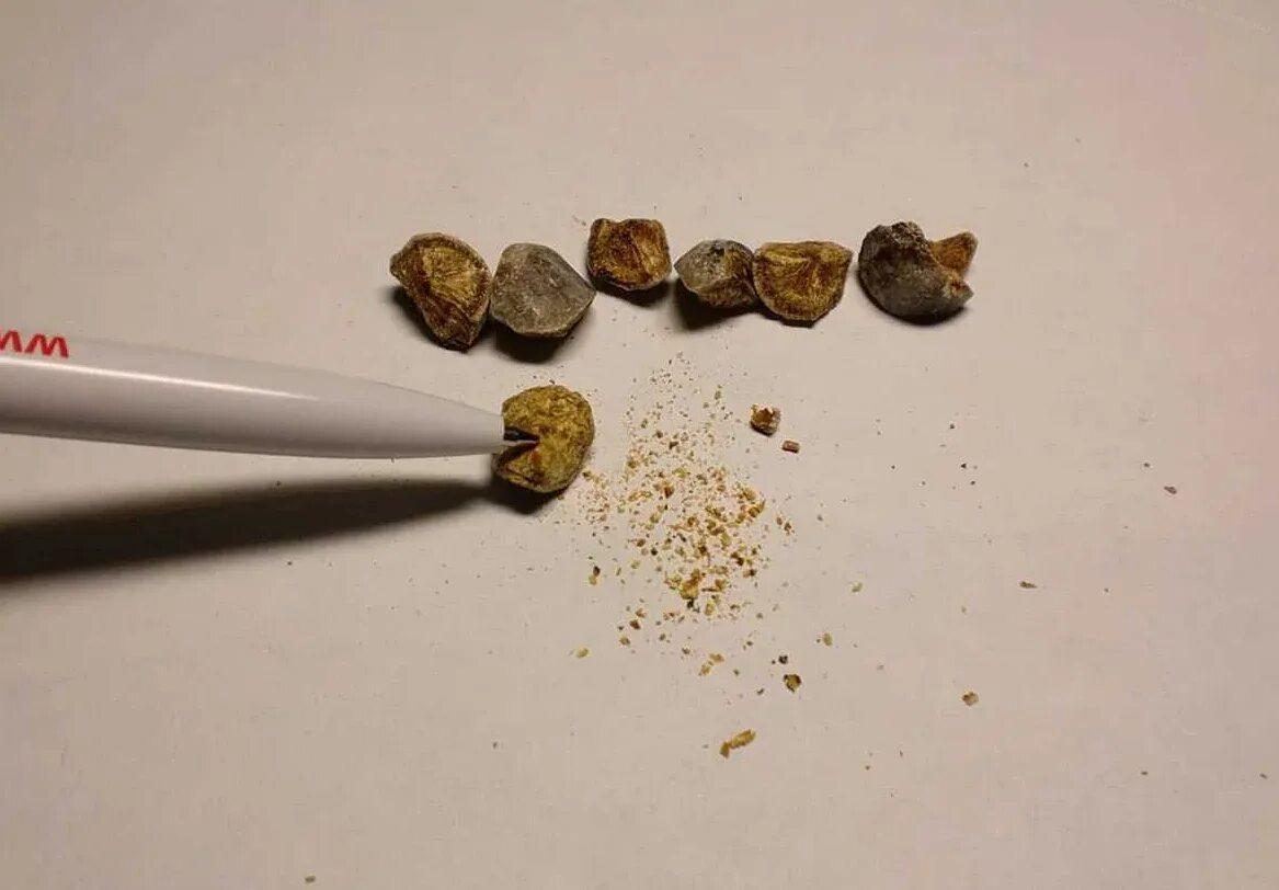 Уратные оксалатные камни в почках. Камни кальцинаты в почках. Камни в почках песок в моче. Конкременты в поджелудочной железе. Как выглядит песок из почек.